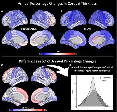 Generalizing Longitudinal Age Effects on Brain Structure – A Two-Study Comparison Approach